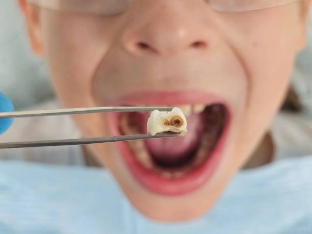 Best Urgent Dental Care for Toothaches in Fifth Ward, LA
