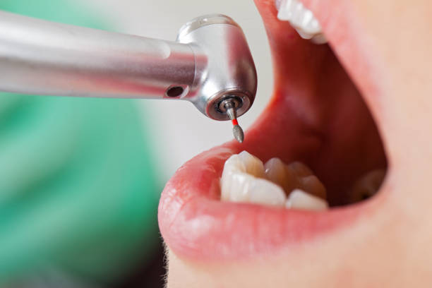 Best Emergency Dental Care for Sports Injuries in Fifth Ward, LA